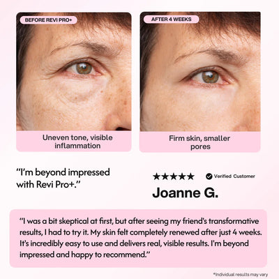 Revi Pro+ Photon Anti-Aging Device - Smuuv Body