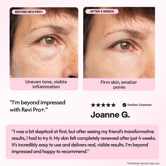 Revi Pro+ Photon Anti-Aging Device - Smuuv Body