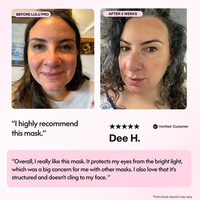 Lulu Pro LED Light Therapy Mask - Smuuv Body